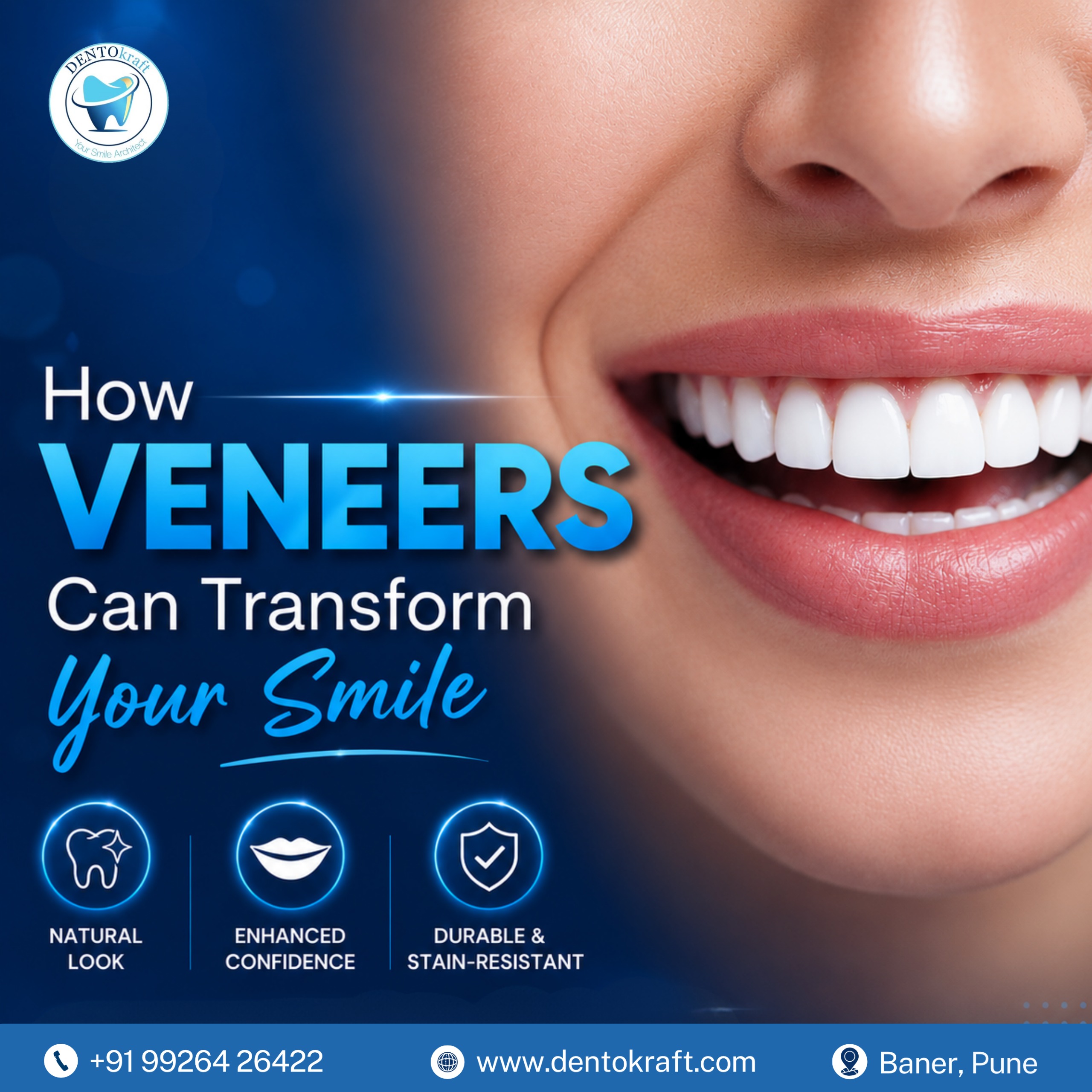  How Veneers Can Transform Your Smile