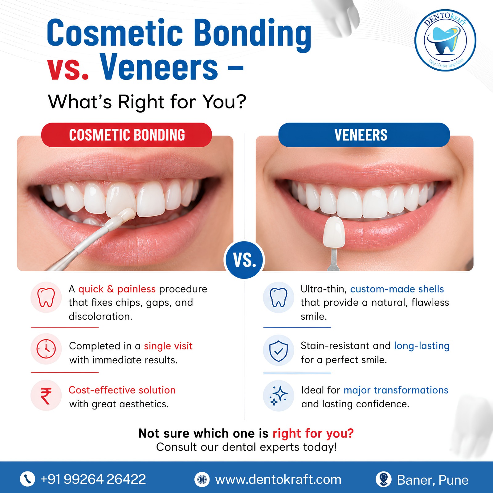  Cosmetic Bonding vs. Veneers – What’s Right for You?